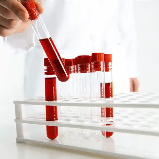 serum phosphorus test